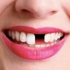 К чему снятся гнилые зубы: толкование по различным сонникам - «Сонник»